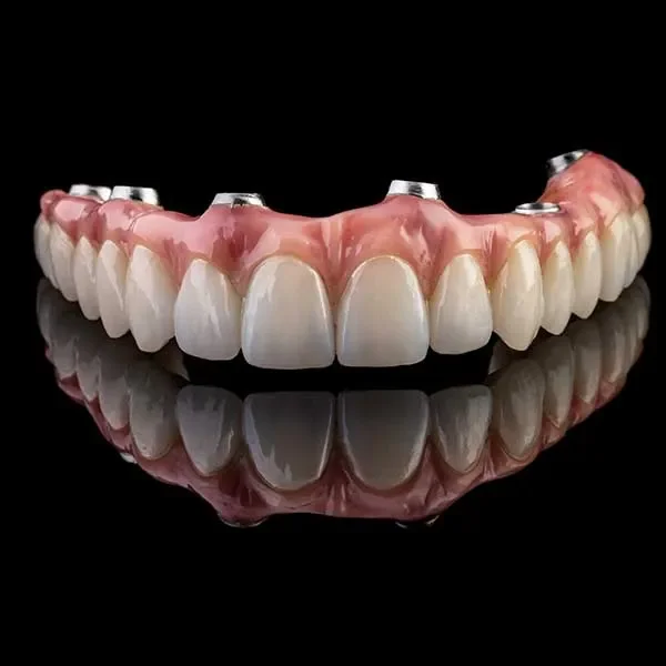 Un bridge sur implants ou une prothèse dentaire sur implants , placé sur un fond noir avec un reflet sous les dents.