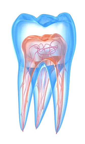 Dent transparente avant un traitement nerveux, traitement canalaire.