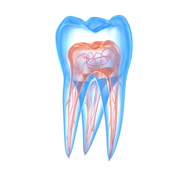 Dent transparente avant un traitement nerveux, traitement canalaire.